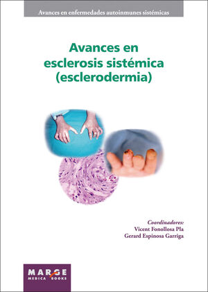 AVANCES EN ESCLEROSIS SISTÉMICA (ESCLERODERMIA)